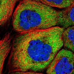 DBPA Antibody, Novus Biologicals:Antibodies:Primary Antibodies